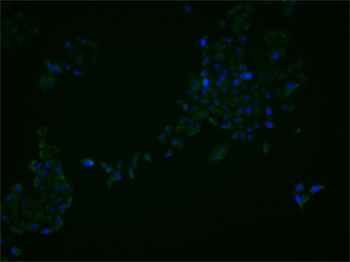 ASPP2 Rabbit Polyclonal Antibody