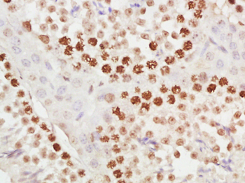 METTL11A Rabbit Polyclonal Antibody