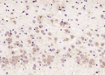 RSRC2 Rabbit Polyclonal Antibody