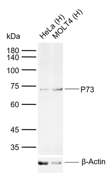 P73 Rabbit Polyclonal Antibody