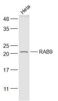 RAB9 Rabbit Polyclonal Antibody