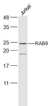 RAB9 Rabbit Polyclonal Antibody