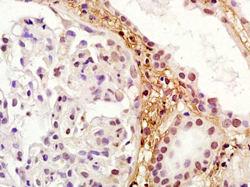 RORC Rabbit Polyclonal Antibody
