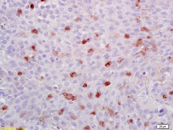 ATF1 Rabbit Polyclonal Antibody