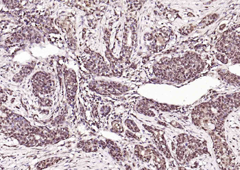 ATF2 Rabbit Polyclonal Antibody