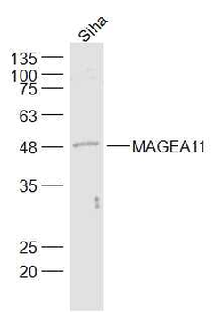 MAGEA11 Rabbit Polyclonal Antibody