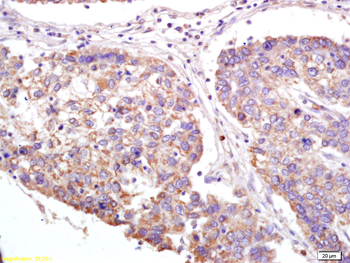 XAGE2 Rabbit Polyclonal Antibody
