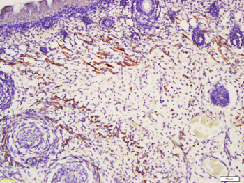 TAGL2 Rabbit Polyclonal Antibody