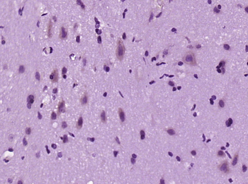 Sprouty 2 Rabbit Polyclonal Antibody