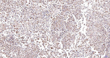 Natriuretic Peptide Receptor A Rabbit Polyclonal Antibody