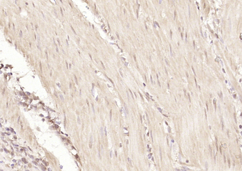 FOXO1 + FOXO3 + FOXO4 Rabbit Polyclonal Antibody