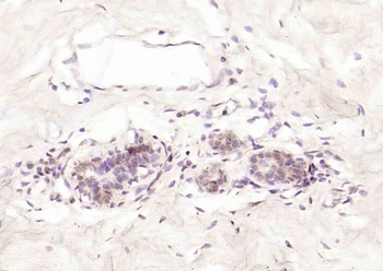 MDM2BP Rabbit Polyclonal Antibody