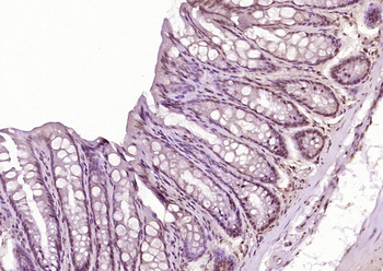 Anillin Rabbit Polyclonal Antibody