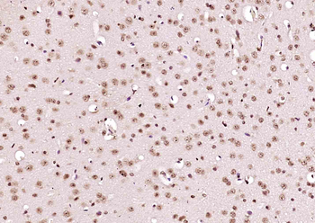 NEK7 Rabbit Polyclonal Antibody