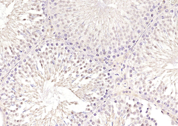 SKA3 Rabbit Polyclonal Antibody