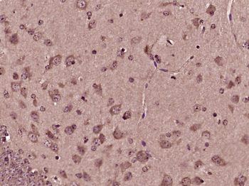 CEND1 Rabbit Polyclonal Antibody
