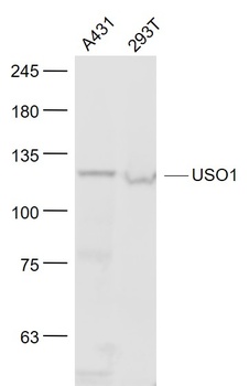 Vesicle docking protein p115 antibody
