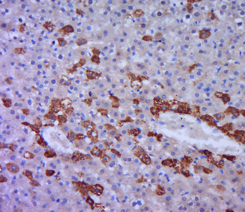 FAT Rabbit Polyclonal Antibody