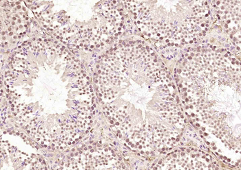 HURP Rabbit Polyclonal Antibody