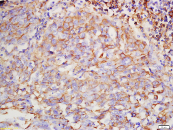 Hyaluronidase2 Rabbit Polyclonal Antibody