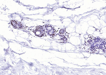 MYB Rabbit Polyclonal Antibody