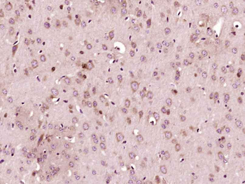Mitofusin 2 Rabbit Polyclonal Antibody