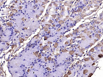 RASAL1 Rabbit Polyclonal Antibody