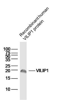 VILIP1 Rabbit Polyclonal Antibody