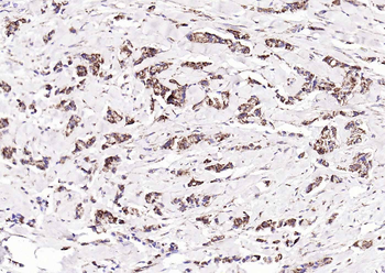 ITIH1 Rabbit Polyclonal Antibody