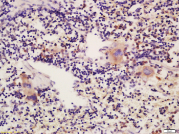 THSD1 Rabbit Polyclonal Antibody
