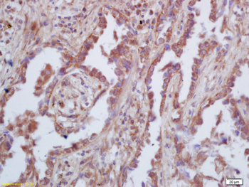 GAS 6 Rabbit Polyclonal Antibody