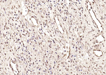 SMC5 Rabbit Polyclonal Antibody