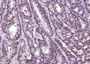BRD7 Rabbit Polyclonal Antibody
