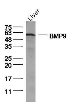 BMP9 Rabbit Polyclonal Antibody