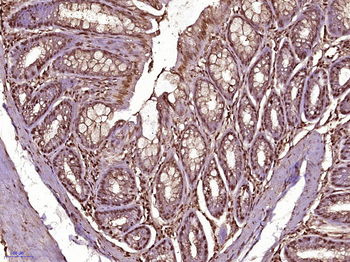 SUPT16H Rabbit Polyclonal Antibody
