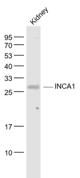 INCA1 Rabbit Polyclonal Antibody
