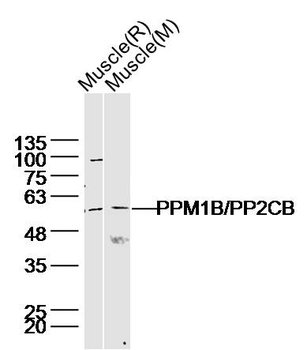 PPM1B Rabbit Polyclonal Antibody