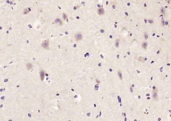 TACC1 Rabbit Polyclonal Antibody