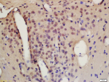TACC1 Rabbit Polyclonal Antibody