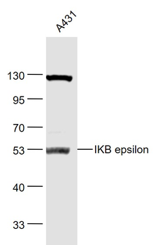 IKB epsilon Rabbit Polyclonal Antibody