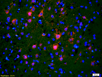 APH1a Rabbit Polyclonal Antibody