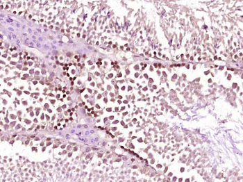Cyclin A1 Rabbit Polyclonal Antibody