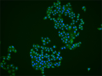 NCOA3 Rabbit Polyclonal Antibody