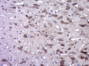 NG2 Rabbit Polyclonal Antibody