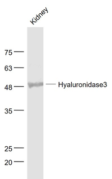 Hyaluronidase3 Rabbit Polyclonal Antibody