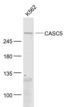 CASC5 Rabbit Polyclonal Antibody