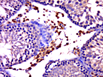 GNAT3 Rabbit Polyclonal Antibody