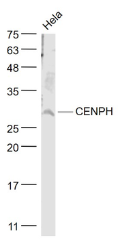 CENPH Rabbit Polyclonal Antibody