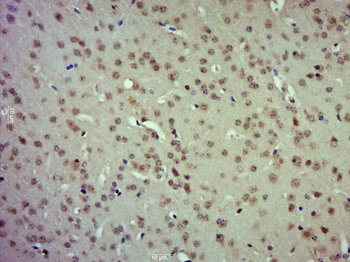 Etv5 Rabbit Polyclonal Antibody