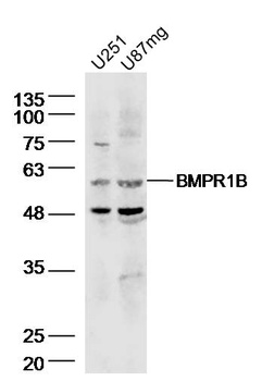 BMPR1B antibody